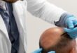 best hair transplant in lahore