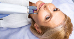 Laser Hair Reduction and Mesotherapy Treatments for Facial